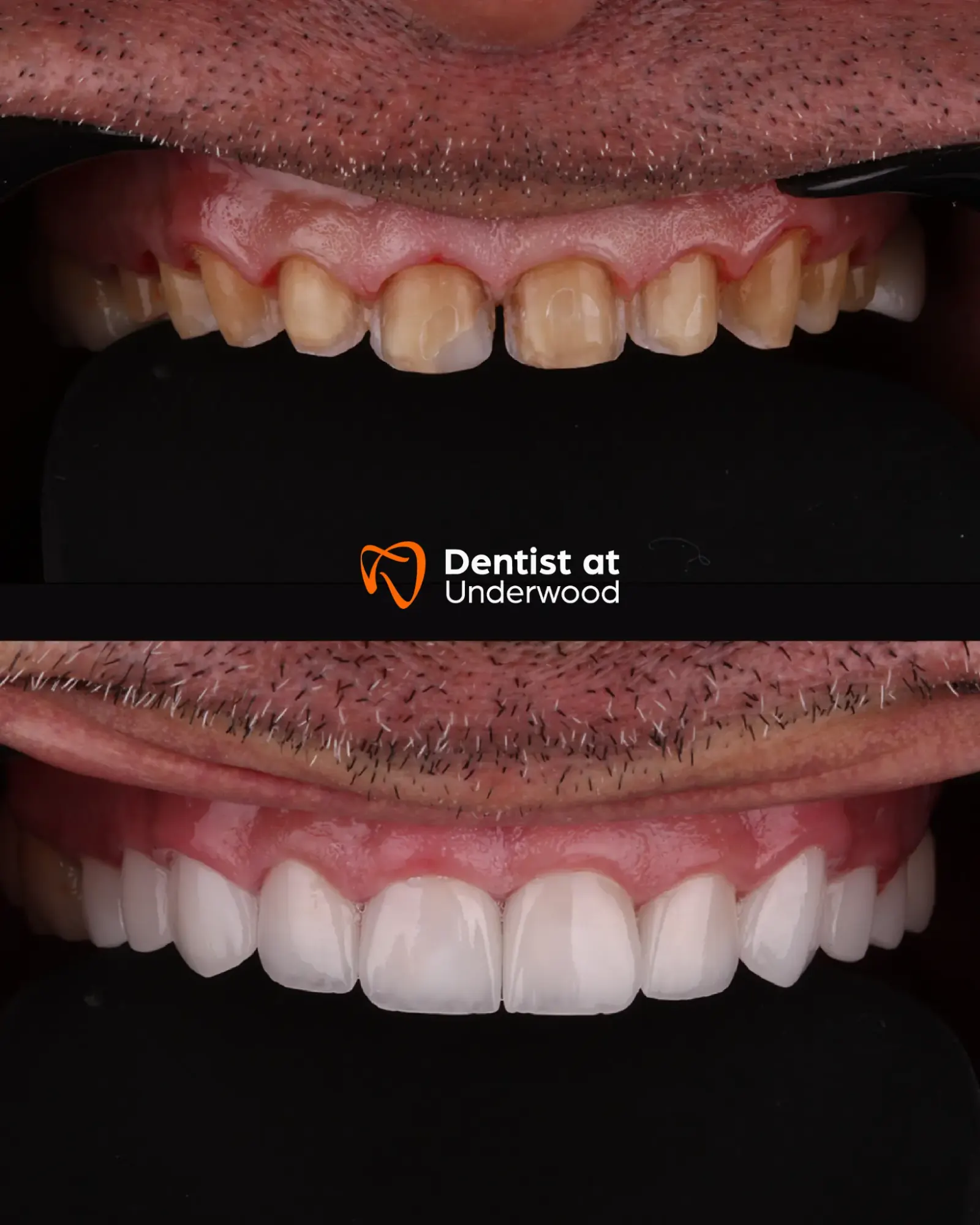 Dental treatment case 1