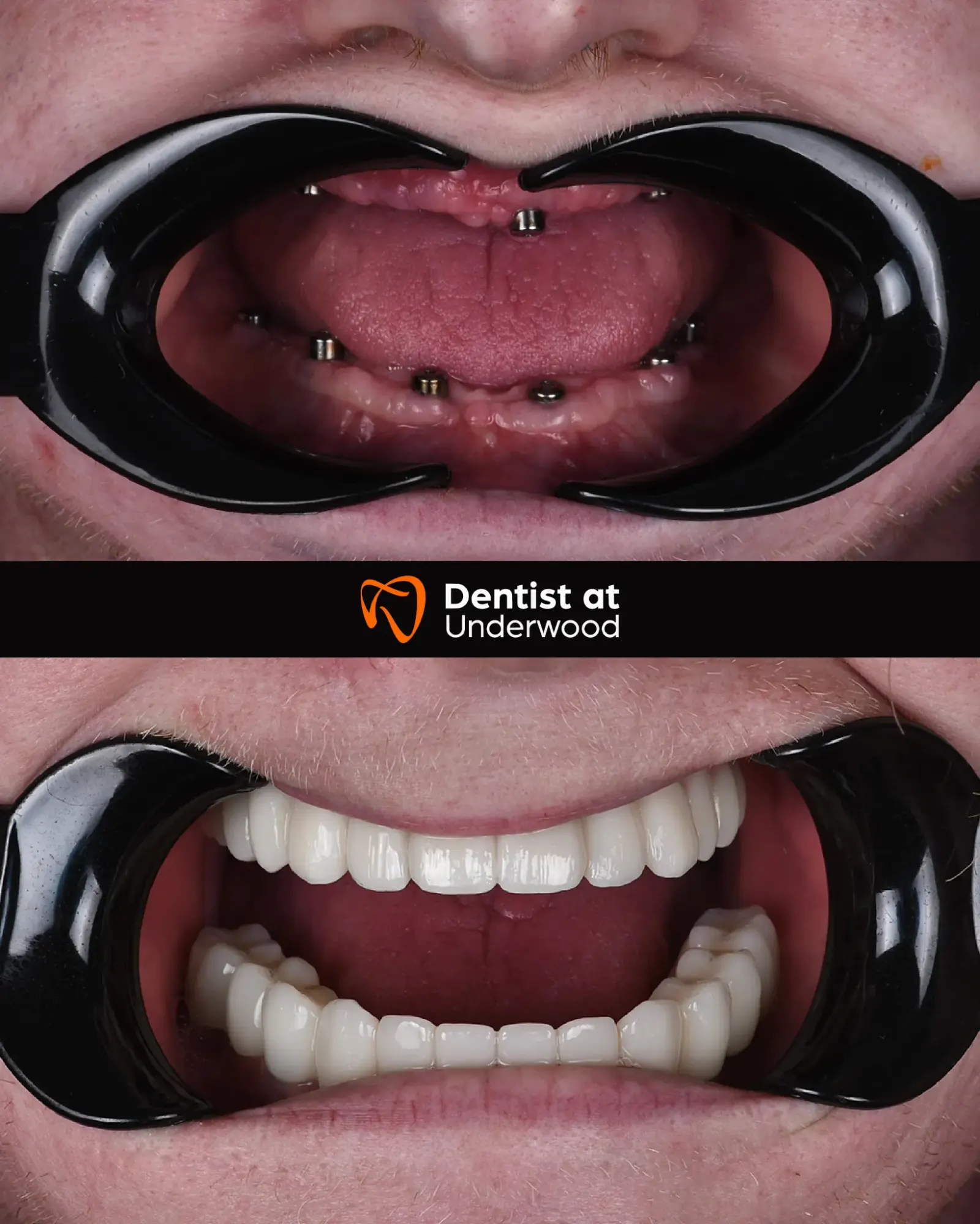Dental treatment case 2