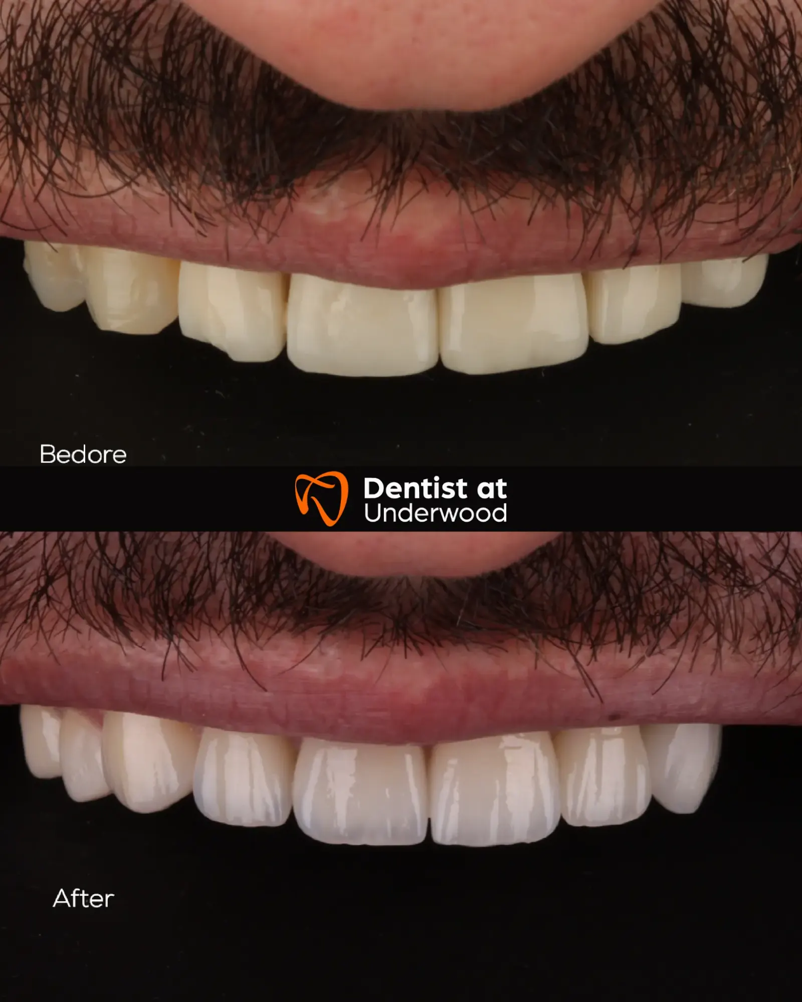 Dental treatment case 6