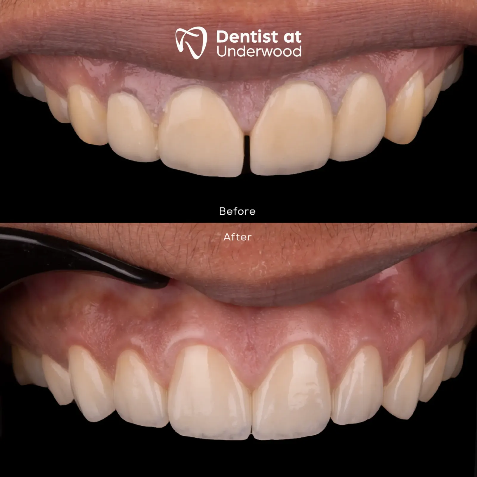 Dental treatment case 10