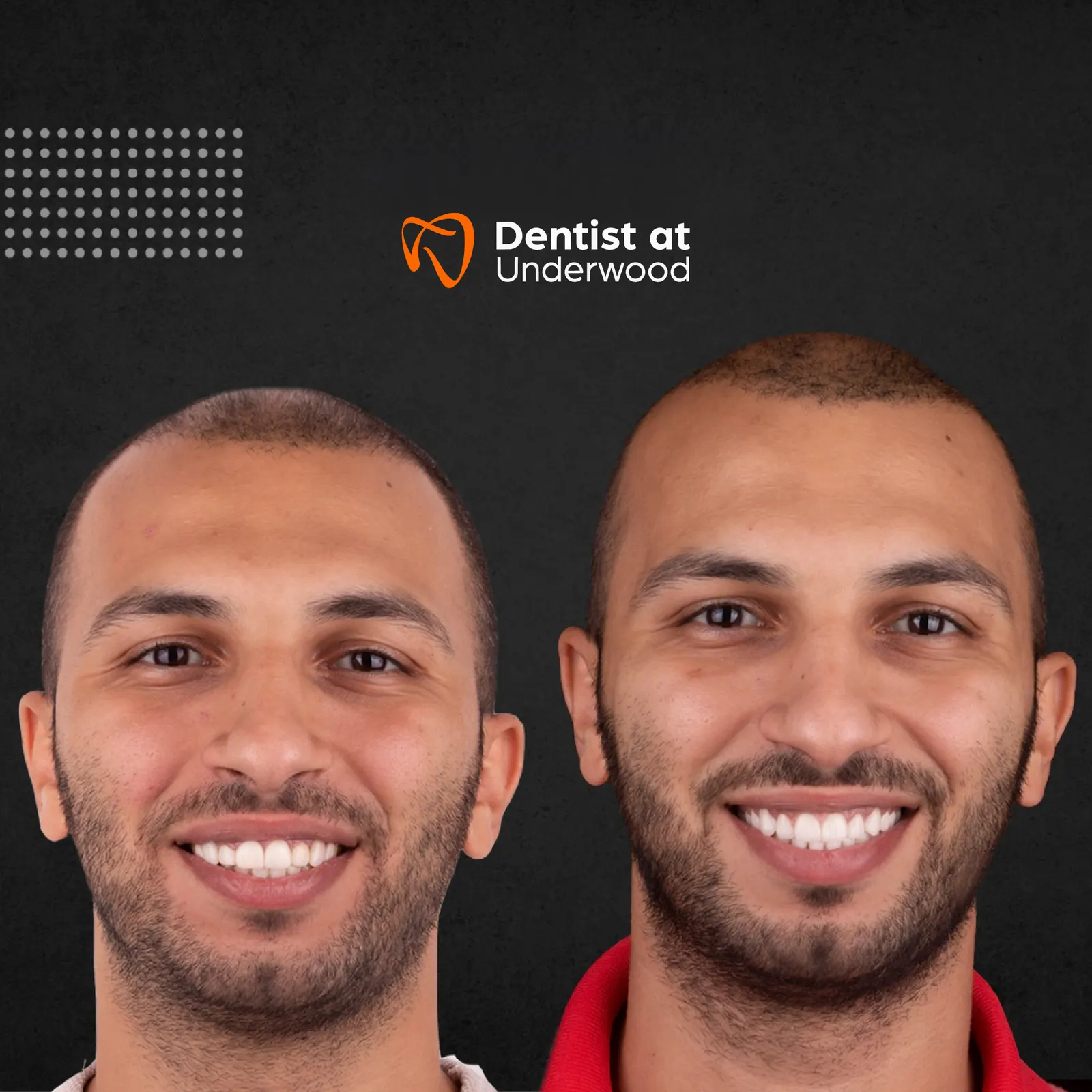Dental treatment case 11