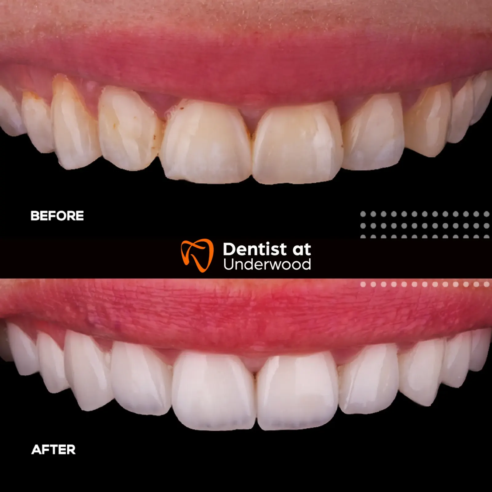 Dental treatment case 15
