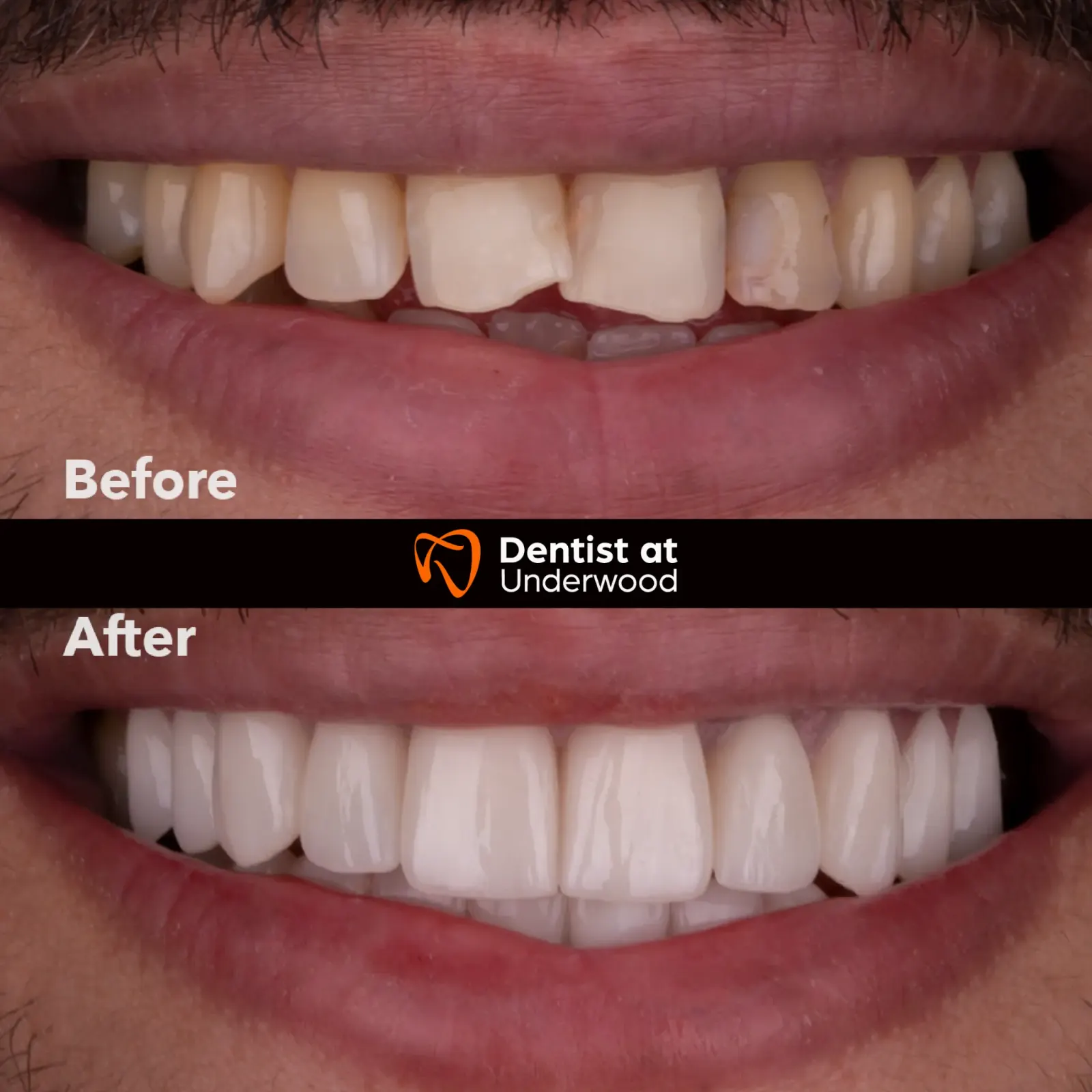 Dental treatment case 17